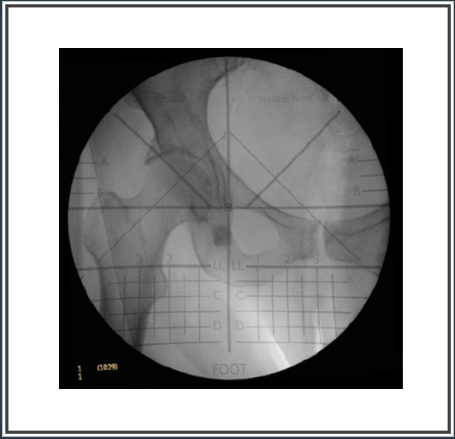 hipgrid-9-inch-teardrop-target-455x439-2